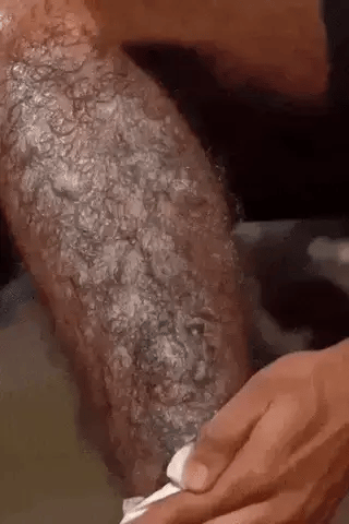 Silky Beauty Hair Removal Spray – Fast & Painless Hair Removal